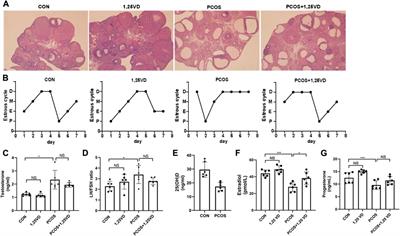 1,25-Dihydroxyvitamin D inhibits hepatic diacyglycerol accumulation and ameliorates metabolic dysfunction in polycystic ovary syndrome rat models